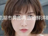 芜湖市鼻部再造抢鲜详细价格表(10月-4月鼻部再造均价为：40494元)
