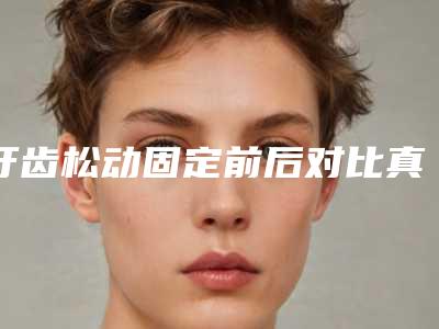 牙齿松动固定前后对比真实效果