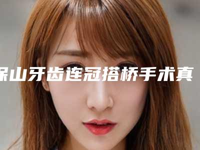 保山牙齿连冠搭桥手术真的会有风险吗