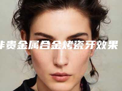 非贵金属合金烤瓷牙效果会好吗