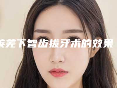 莱芜下智齿拔牙术的效果好不好