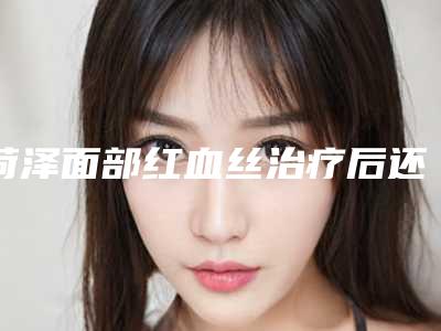 菏泽面部红血丝治疗后还要怎么样做护理(在怎么样治疗面部血丝)