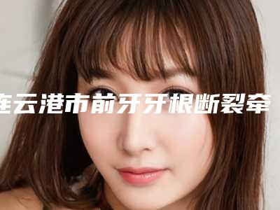 连云港市前牙牙根断裂牵引医院在榜名单top10名单揭开(东海县广大口腔诊所做手术名气很大哦)