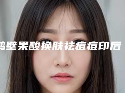 鹤壁果酸换肤祛痘痘印后应该怎么护理鼻子